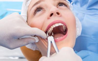 Estrazione dei Denti Senza Dolore a Roma e Milano