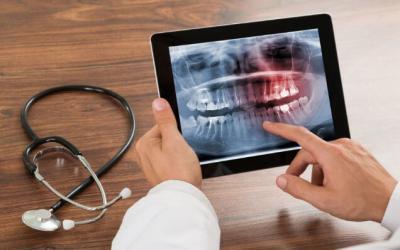 Teleodontoiatria: ovvero la consulenza dentistica da remoto