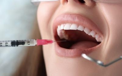 L’anestesia dal dentista fa male?