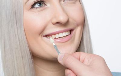 Faccette dentali: così torna il sorriso